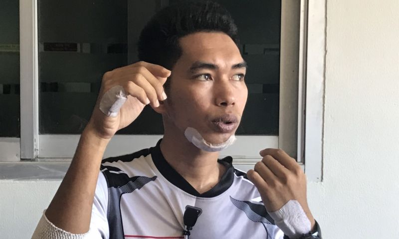 ตร.ตามเอาผิดเจ้าของสายเคเบิ้ลละเลย ทำหนุ่มดวงซวยควบจยย. เกี่ยวสายห้อยกลางถนนล้มเจ็บ