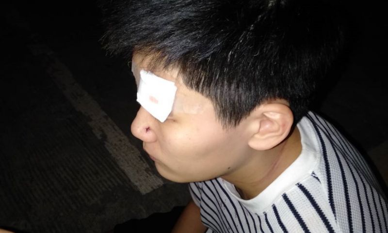 นทท.จีนอ้างโดนตุ๊กตุ๊กทำร้ายเลือดอาบหน้า วิ่งขอความช่วยเหลือผช.ผญบ.