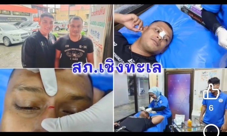 สภ.เชิงทะเล โพสต์คลิปชื่นชมเพื่อนร่วมงาน “แม้จะบาดเจ็บจากการปฏิบัติหน้าที่ ก็ขอให้ประชาชนปลอดภัย”