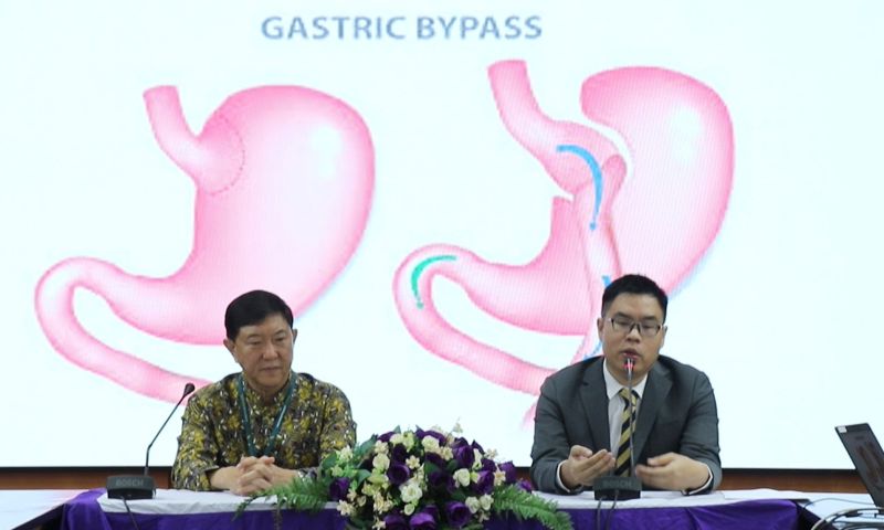 รพ.วชิระภูเก็ตแถลงความก้าวหน้า การผ่าตัดลดน้ำหนักและการดูแลผู้ป่วยโรคอ้วนทุพพลภาพ